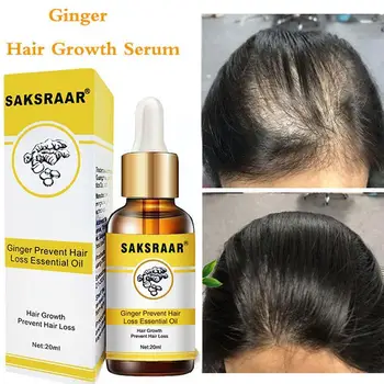 Сыворотка-Спрей Fast Serum Hair Thinning Treatment Жидкая Против Выпадения Волос Для Женщин И Мужчин Y9H8
